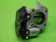 Drosselklappenelement OPEL ASTRA L (OV5) 1.5 Turbo D (FBYHZT, FBYHZJ) 9830171480