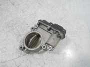 Drosselklappe f?r Mercedes A-Klasse 2,0 OM654.920 654.920 A6540900070