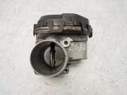 Drosselklappe f?r Opel Peugeot Citroen 1,5 BlueHDi DV5RUCD YHR D15DT 9830171480