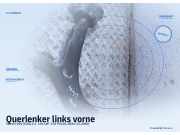 Querlenker links vorne VOLVO V50 (545)