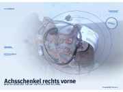 Achsschenkel rechts vorne BMW 3er (E36)
