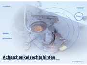Achsschenkel rechts hinten MERCEDES-BENZ C-Klasse (W203)