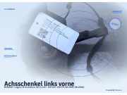 Achsschenkel links vorne RENAULT Laguna II Grandtour (G)