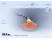 Blinker FORD Fiesta IV (JA, JB)