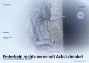 Federbein rechts vorne mit Achsschenkel Mercedes-Benz Cla Coupe (C117)