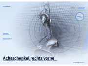 Achsschenkel rechts vorne FORD Mondeo IV Turnier (BA7)