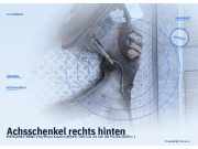 Achsschenkel rechts hinten MERCEDES-BENZ Vito/Mixto Kasten (W639)