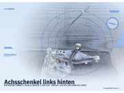 Achsschenkel links hinten MERCEDES-BENZ C-Klasse (W203)
