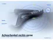 Achsschenkel rechts vorne RENAULT Twingo I (C06)