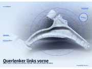 Querlenker links vorne OPEL Astra J (P10)
