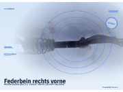 Federbein rechts vorne HONDA Shuttle (RA)