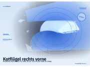 Kotflügel rechts vorne HYUNDAI Elantra (XD)