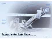 Achsschenkel links hinten MERCEDES-BENZ CLA Coupe (C117)