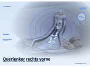 Querlenker rechts vorne OPEL Corsa C (X01)