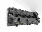 KIA Carens RP IV 13-19 CRDi 1,7 100KW D4FDVentildeckel Zylinderkopfhaube