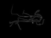 Audi A1 8X 10-14 TDI 1,6 66KW Leitung Kraftstoffleitung Kraftstoffschlauch