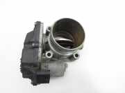 Hyundai I40 CW 11-15 CRDi 1,7 100KW D4FD Drosselklappe