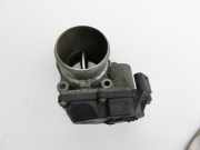 KIA Carens RP IV 13-19 CRDi 1,7 100KW D4FD Drosselklappe