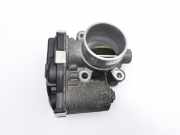 Opel Astra K B16 15-19 CDTi 1,6 100KW B16DTH Drosselklappe