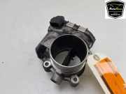 Drosselklappe 31216665 Volvo V70 (BW) Kombi 2.0 D3/D4 20V (D5204T2) 2013-01