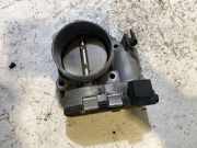 Drosselklappe VOLVO S40 II (MS) 2.0 8658497