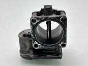 Drosselklappe KIA SORENTO I (JC) 2.5 CRDi 151011544 351002F600