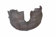 Radhaus links hinten Audi TT (8J) 8J0810171E
