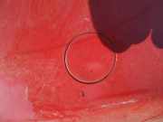 Abdeckung Abschlepphaken - Hinten Opel Corsa, D 2006.07 - 2010.06 Gebraucht,