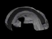 Radhausschale - Hinten Linke Volvo S80, 2006.03 - 2010.01 30661129,