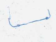 Stabilisator Vorne Citroen C3, I 2002.02 - 2005.06 Gebraucht,