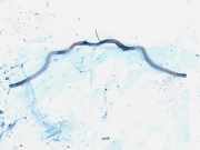 Stabilisator Vorne Renault Scenic, I 1996.01 - 1999.09 Gebraucht,