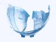 Radhausschale - Vorne Linke Volvo S80, 1998.05 - 2004.06 9190960,