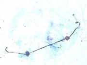 Stabilisator Stabi Hinten Hinterachse BMW 1-Series, E81 E82 2003.09 - 2006.09 Gebraucht,