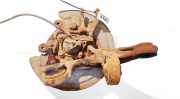 Achsschenkel Radnabe - Hinten Rechts Toyota Avensis, II 2003.04 - 2006.03 Gebraucht,