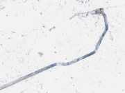 Stabilisator Stabi Hinten Hinterachse Mercedes-Benz W210, 1999.07 - 2002.03 facelift Gebraucht,