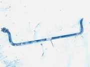 Stabilisator Vorne Kia Sorento, I 2002.01 - 2009.06 Gebraucht,