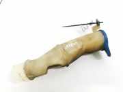 Verschluss Waschwasserbehälter Volvo S60, 2000.01 - 2005.01 Gebraucht ,