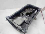 Ölwannenabdeckung 215102A311 Kia Carens IV (RP) Großraumlimousine 1.7 CRDi 16V (D4FD)