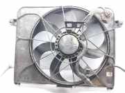 Kühlerventilator 253861D401 Kia Carens III (FG) Großraumlimousine 2.0 CRDI VGT 16V (D4EA)