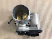 Drosselklappe 3510007250 Kia Stonic (YB) SUV 1.0i T-GDi 12V Eco-Dynamics+ (G3LF) 2022-11
