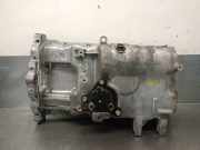 Ölwannenabdeckung 215102A311 Kia Carens IV (RP) Großraumlimousine 1.7 CRDi 16V (D4FD)