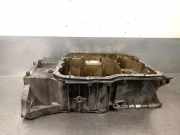 Ölwannenabdeckung 215102F000 Kia III (SL) 2.0 CRDi