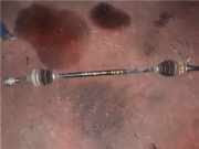 Antriebswelle Rechts Hinten Nissan (T32)(04.2014->) 1.6 Acenta 4x4 [1,6 Ltr. - 96 kW dCi Turbodiesel CAT] R9M410 2015