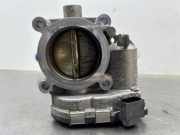 Drosselklappenstutzen Mercedes-Benz B-Klasse Sports Tourer W245 A2661410525