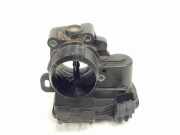Drosselklappe 9806625280 Peugeot Standard