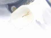 Fensterhebermotor Rechts Hinten 5179962AA Dodge Caliber Schrägheck 2.0 CRD 16V (ECD) 2007