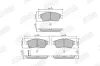 Bremsbelagsatz, Scheibenbremse Vorderachse JURID 572545J Bild Bremsbelagsatz, Scheibenbremse Vorderachse JURID 572545J