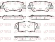 Bremsbelagsatz, Scheibenbremse REMSA 1362.85
