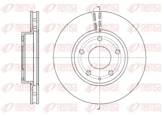 Bremsscheibe Vorderachse REMSA 61573.10 Bild Bremsscheibe Vorderachse REMSA 61573.10