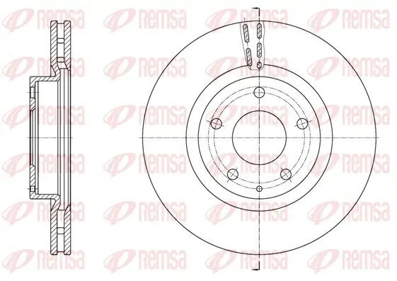 Bremsscheibe Vorderachse REMSA 61574.10